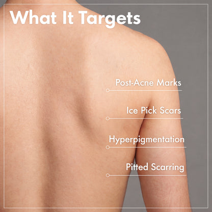 Scar Labs™ – Arbutin 7% + Tranexamic Acid 4% Cream